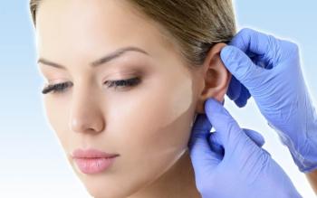 The operations that can be combined with rhinoplasty; rhinoplasty and otoplasty